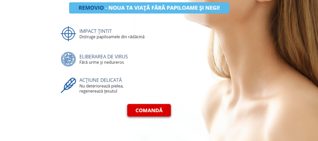 Removio Preț