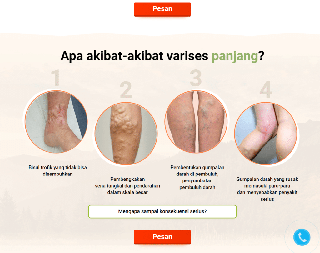 Varius Harga
