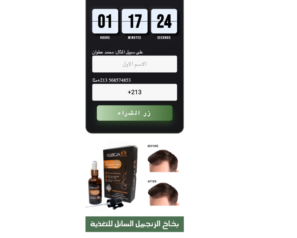 Aldelux المراجعات